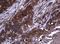 Conserved oligomeric Golgi complex subunit 6 antibody, LS-C787758, Lifespan Biosciences, Immunohistochemistry paraffin image 