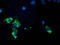 Pyruvate Dehydrogenase E1 Alpha 1 Subunit antibody, TA502704, Origene, Immunofluorescence image 