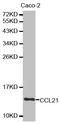 C-C Motif Chemokine Ligand 21 antibody, LS-C331756, Lifespan Biosciences, Western Blot image 