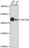 Unc-13 Homolog B antibody, A05240, Boster Biological Technology, Western Blot image 