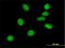 ATM Interactor antibody, H00023300-B01P, Novus Biologicals, Immunofluorescence image 