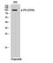 Progesterone Receptor antibody, STJ90691, St John