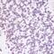 Jumonji Domain Containing 6, Arginine Demethylase And Lysine Hydroxylase antibody, GTX33278, GeneTex, Immunohistochemistry paraffin image 
