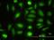 Probable aminopeptidase NPEPL1 antibody, MA5-22592, Invitrogen Antibodies, Immunofluorescence image 