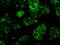 Replication Protein A2 antibody, GTX83695, GeneTex, Immunocytochemistry image 