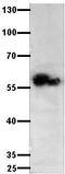 Growth Factor Receptor Bound Protein 14 antibody, TA322736, Origene, Western Blot image 