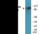 Phosphodiesterase 4D antibody, EKC2104, Boster Biological Technology, Western Blot image 