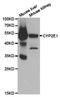 Cytochrome P450 Family 2 Subfamily E Member 1 antibody, TA327304, Origene, Western Blot image 