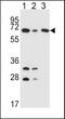 Dihydrolipoamide S-Acetyltransferase antibody, PA5-25260, Invitrogen Antibodies, Western Blot image 