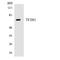 General Transcription Factor IIH Subunit 1 antibody, LS-B12506, Lifespan Biosciences, Western Blot image 