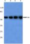 Matrix Metallopeptidase 14 antibody, AP06227PU-N, Origene, Western Blot image 