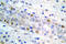 Estrogen Receptor 1 antibody, AP21027PU-N, Origene, Immunohistochemistry frozen image 