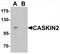 CASK Interacting Protein 2 antibody, TA319976, Origene, Western Blot image 