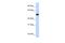 Chromosome 9 Open Reading Frame 43 antibody, A18370, Boster Biological Technology, Western Blot image 