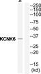 Potassium channel subfamily K member 6 antibody, PA5-39347, Invitrogen Antibodies, Western Blot image 