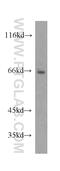 Solute Carrier Family 11 Member 2 antibody, 20507-1-AP, Proteintech Group, Western Blot image 
