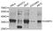 Centromere Protein H antibody, STJ110670, St John