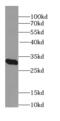 E3 ubiquitin-protein ligase MARCH5 antibody, FNab05003, FineTest, Western Blot image 