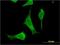 6-Phosphogluconolactonase antibody, H00025796-M01, Novus Biologicals, Immunocytochemistry image 