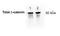 Catenin Beta 1 antibody, TA336809, Origene, Western Blot image 