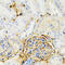 Galactose-1-phosphate uridylyltransferase antibody, 22-105, ProSci, Immunohistochemistry paraffin image 