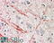 Fibroblast Growth Factor 23 antibody, 42-859, ProSci, Western Blot image 