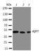 Aquaporin 2 antibody, LS-C312893, Lifespan Biosciences, Western Blot image 