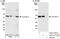 Coronin 1B antibody, A301-316A, Bethyl Labs, Western Blot image 