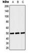 Septin-6 antibody, LS-C353345, Lifespan Biosciences, Western Blot image 