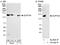 SPT5 Homolog, DSIF Elongation Factor Subunit antibody, A300-869A, Bethyl Labs, Immunoprecipitation image 