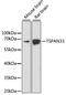 Tetraspanin 33 antibody, A5222, ABclonal Technology, Western Blot image 