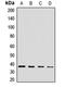 Coproporphyrinogen Oxidase antibody, LS-C667749, Lifespan Biosciences, Western Blot image 