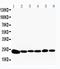 Peroxiredoxin 2 antibody, PA1834, Boster Biological Technology, Western Blot image 