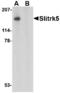 SLIT And NTRK Like Family Member 5 antibody, LS-C53258, Lifespan Biosciences, Western Blot image 