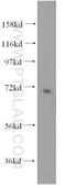 3'-Phosphoadenosine 5'-Phosphosulfate Synthase 2 antibody, 15978-1-AP, Proteintech Group, Western Blot image 