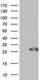 Sperm surface protein Sp17 antibody, CF804221, Origene, Western Blot image 