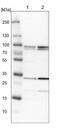 N(Alpha)-Acetyltransferase 35, NatC Auxiliary Subunit antibody, NBP1-90032, Novus Biologicals, Western Blot image 