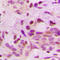 Heterogeneous Nuclear Ribonucleoprotein D antibody, LS-C356107, Lifespan Biosciences, Immunohistochemistry frozen image 