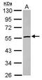 Glucosylceramidase Beta 3 (Gene/Pseudogene) antibody, PA5-30782, Invitrogen Antibodies, Western Blot image 
