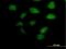 Zinc finger and BTB domain-containing protein 32 antibody, H00027033-B02P, Novus Biologicals, Immunocytochemistry image 