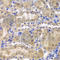 Ribosomal Protein L5 antibody, A1977, ABclonal Technology, Immunohistochemistry paraffin image 