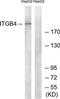 ITGB4 antibody, TA314096, Origene, Western Blot image 