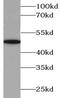 4-Aminobutyrate Aminotransferase antibody, FNab00026, FineTest, Western Blot image 