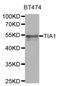 Nucleolysin TIA-1 antibody, orb247318, Biorbyt, Western Blot image 