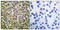 Phospholipase C Gamma 2 antibody, LS-C199477, Lifespan Biosciences, Immunohistochemistry paraffin image 