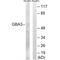 Glucosylceramidase Beta 3 (Gene/Pseudogene) antibody, A08549, Boster Biological Technology, Western Blot image 