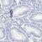 Spermatogenesis Associated 3 antibody, HPA018254, Atlas Antibodies, Immunohistochemistry frozen image 