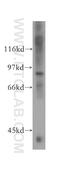 Hyperpolarization Activated Cyclic Nucleotide Gated Potassium Channel 3 antibody, 13745-1-AP, Proteintech Group, Western Blot image 