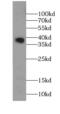 Survival Of Motor Neuron 2, Centromeric antibody, FNab08034, FineTest, Western Blot image 