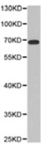 Beta-Transducin Repeat Containing E3 Ubiquitin Protein Ligase antibody, TA324231, Origene, Western Blot image 